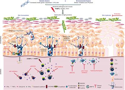 Targeting Innate Immunity to Combat Cutaneous Stress: The Vitiligo Perspective